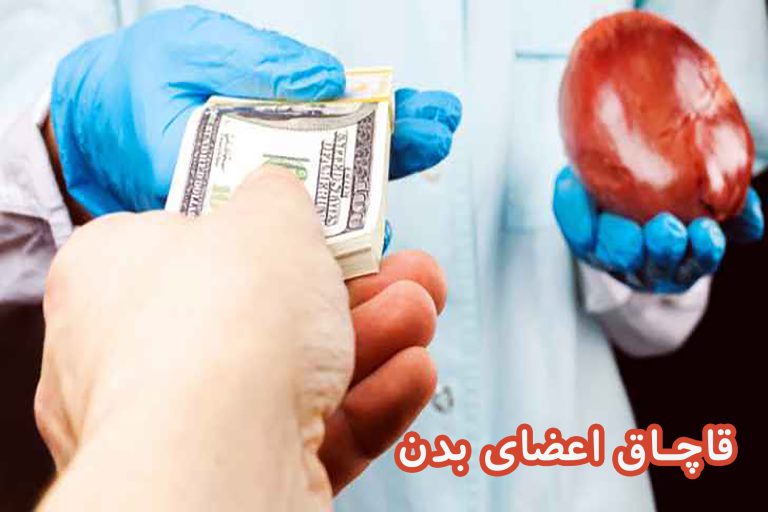 قاچاق اعضای بدن